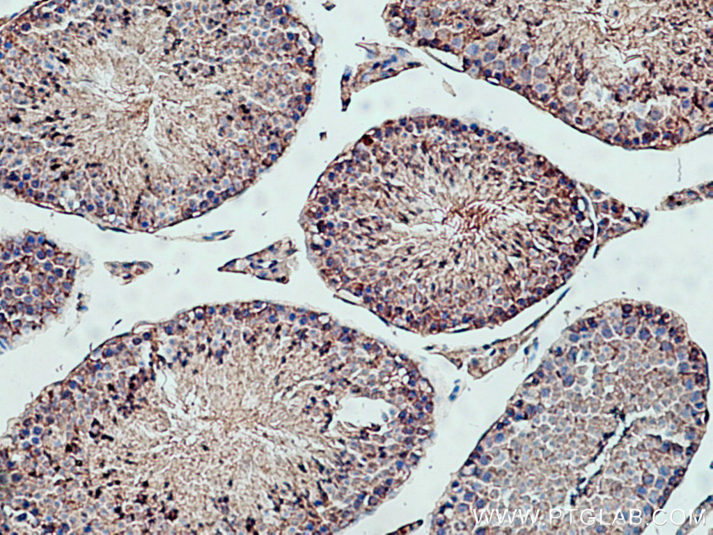 PPP6C Polyclonal antibody