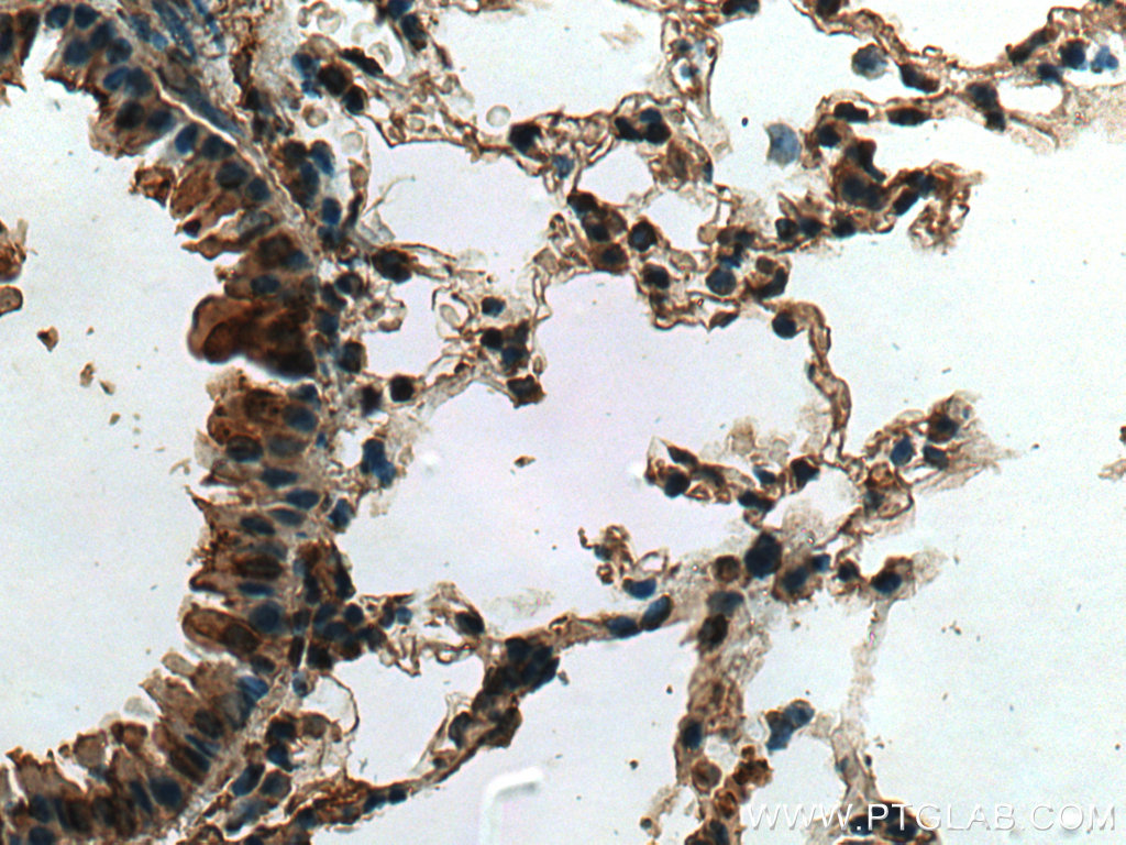 CYTL1 Polyclonal antibody