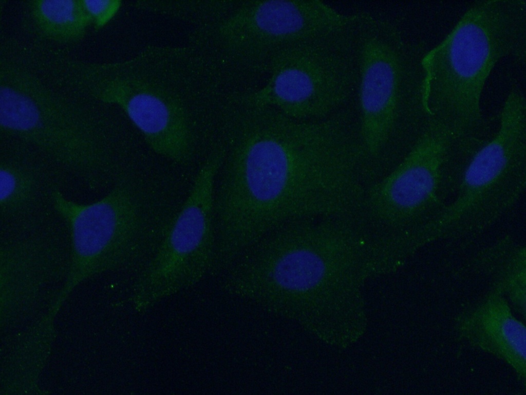 CAP2 Polyclonal antibody