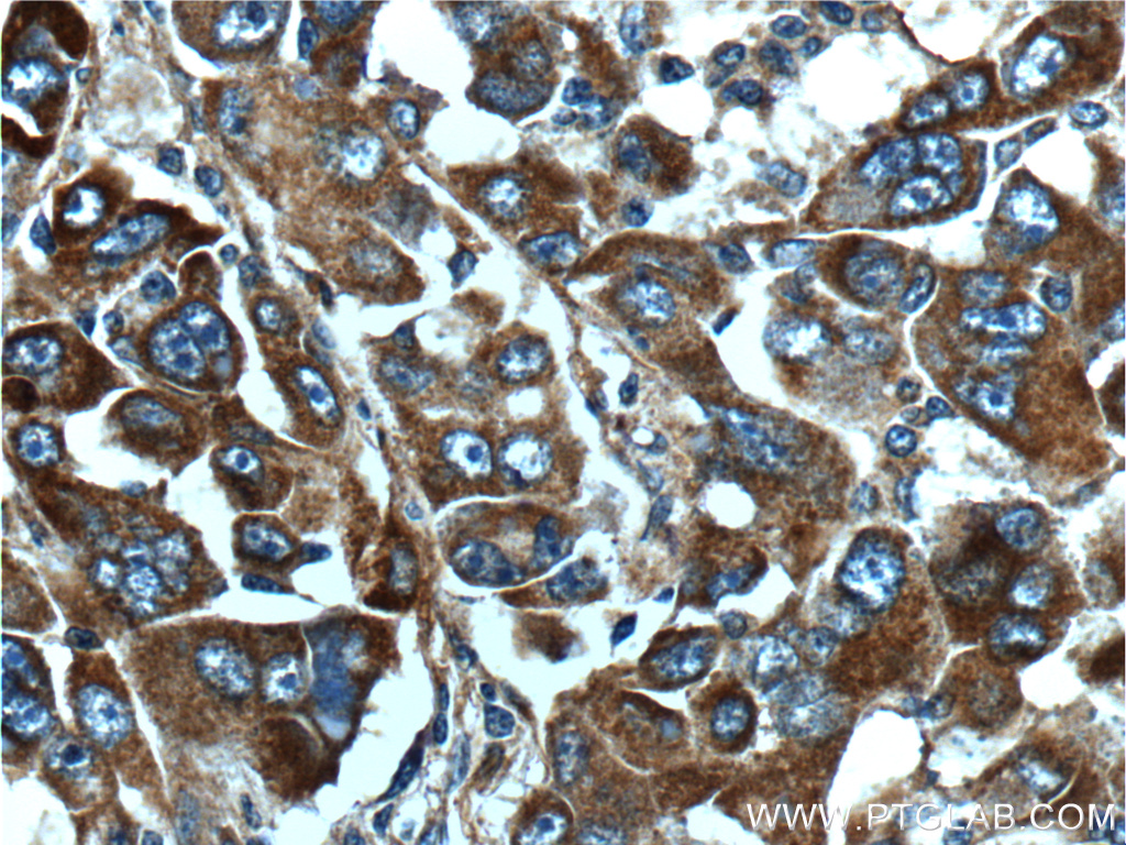 TDO2 Polyclonal antibody