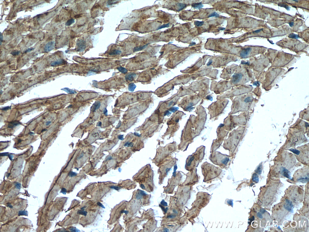 CKM/CKB Polyclonal antibody