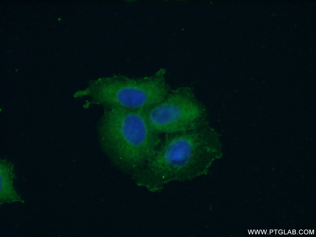 SH3GLB2 Polyclonal antibody