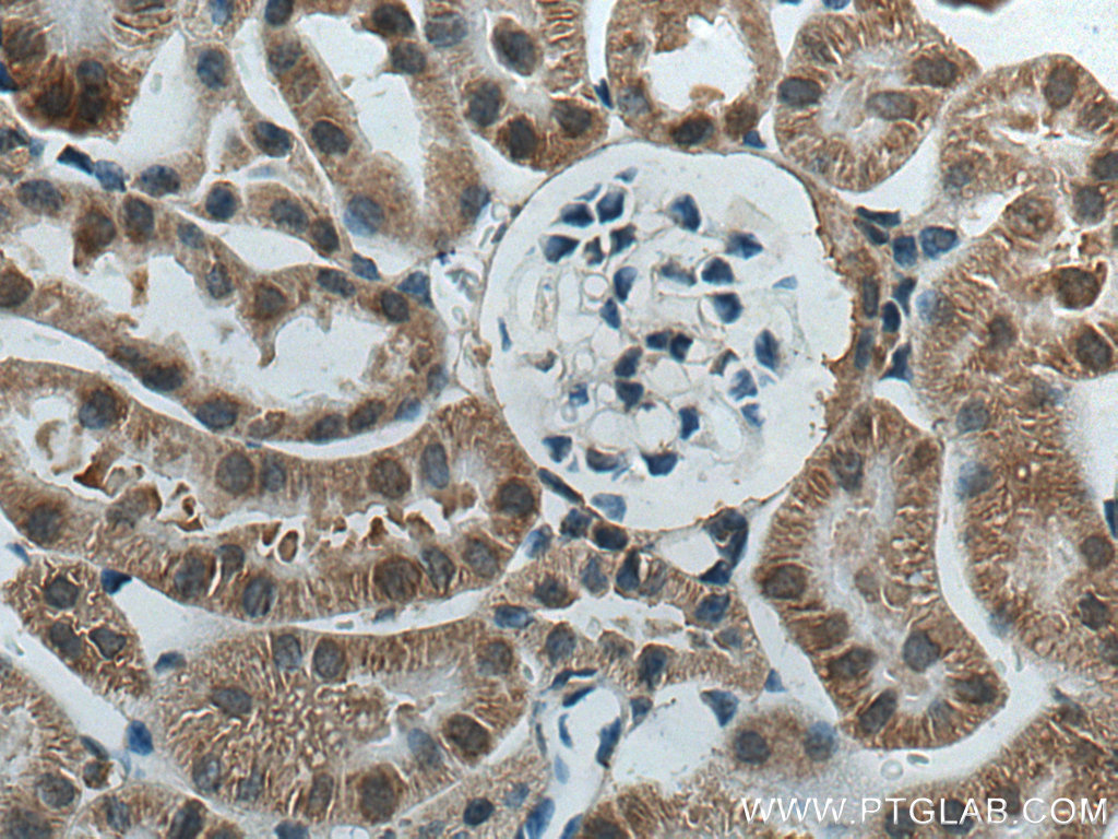 ACOT9 Polyclonal antibody