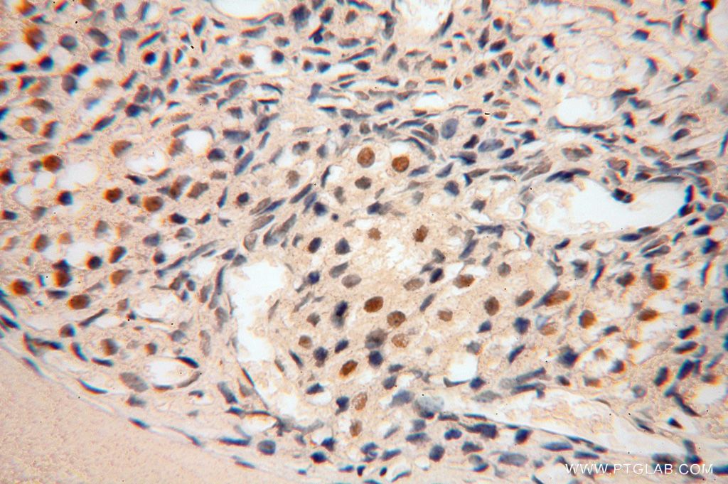 POLR1C Polyclonal antibody