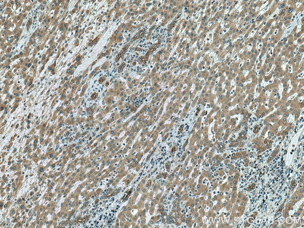SLC12A4 Polyclonal antibody