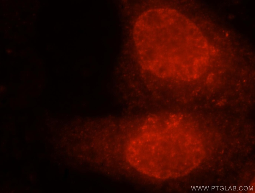 EXOSC4 Polyclonal antibody