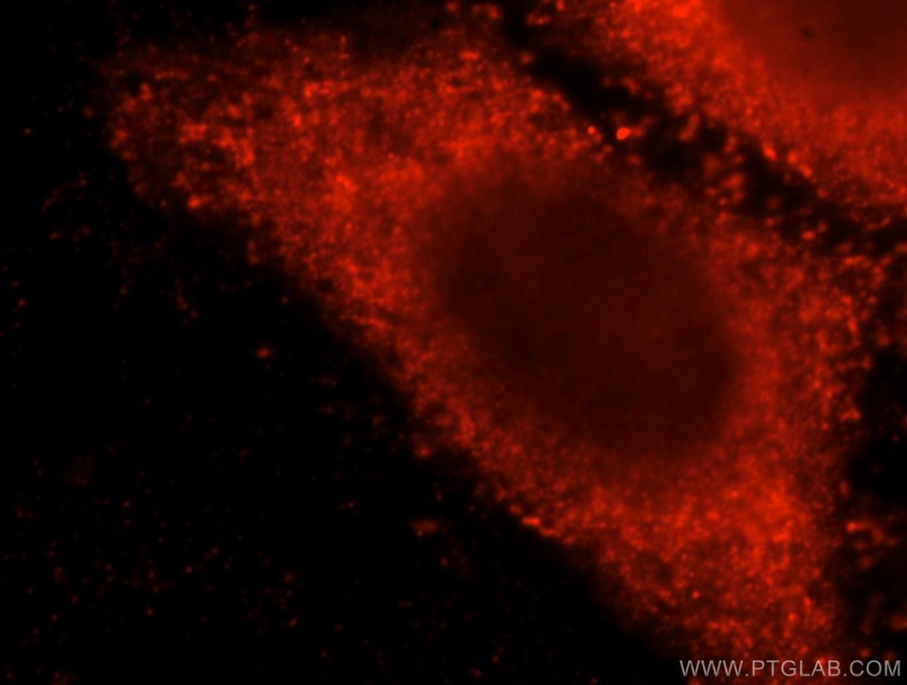CNOT10 Polyclonal antibody