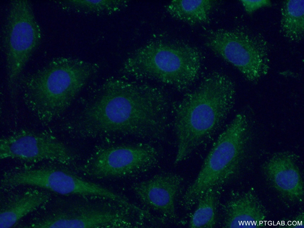 Piezo1 (extracellular domain) Polyclonal antibody