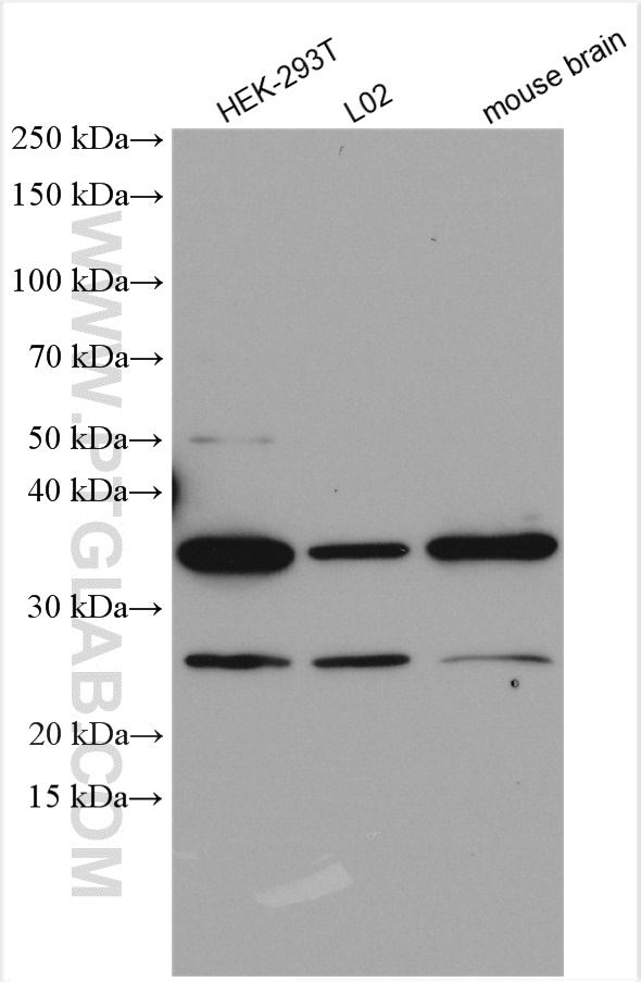 DYNC2LI1 Polyclonal antibody