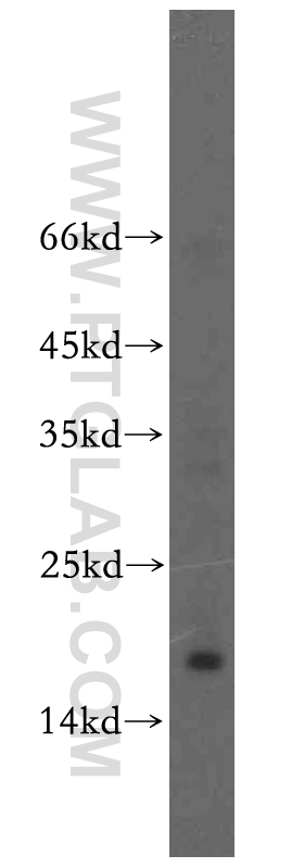 UTP23 Polyclonal antibody