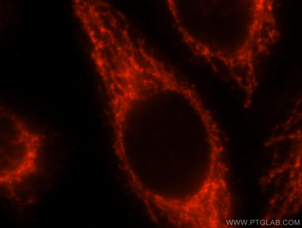 SEC24A Polyclonal antibody