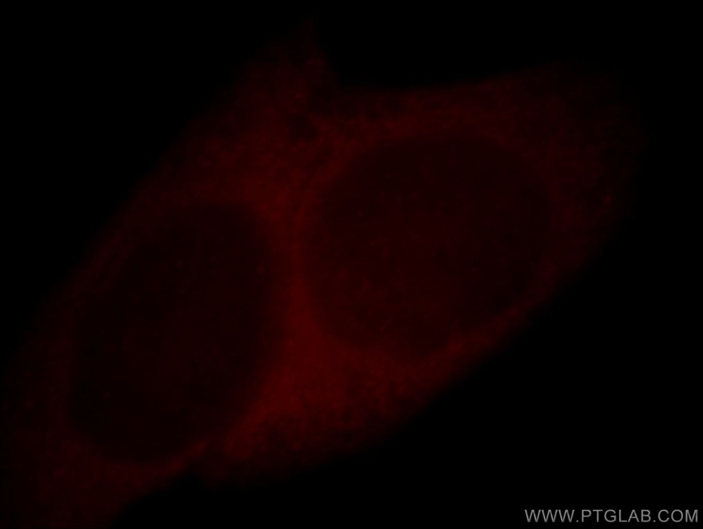 Cystatin A Polyclonal antibody