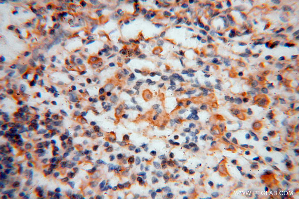 BHMT Polyclonal antibody