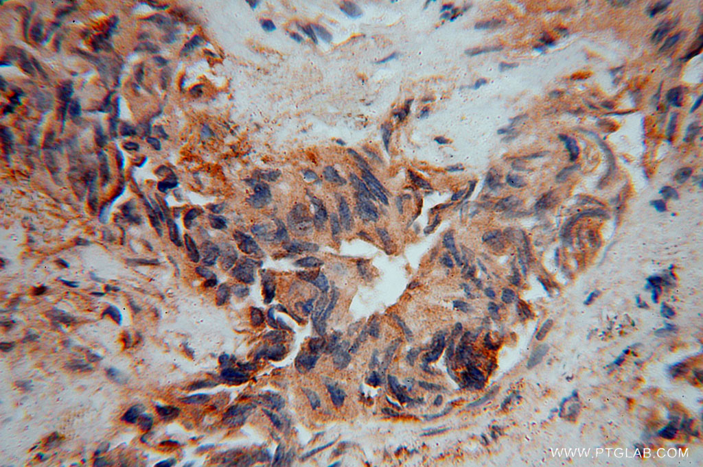 IMMP2L Polyclonal antibody