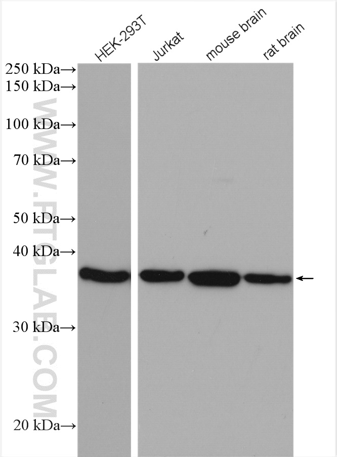 ACOT7 Polyclonal antibody