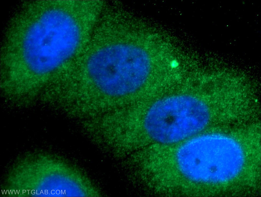 TELO2 Polyclonal antibody