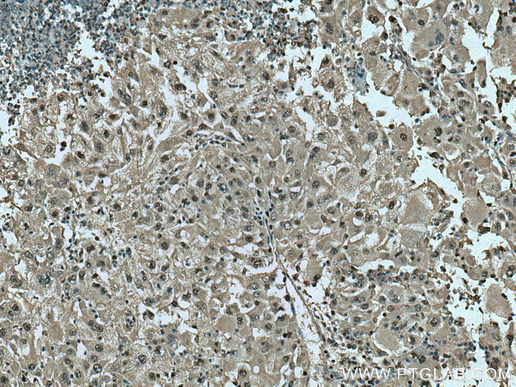 PSMB10 Polyclonal antibody