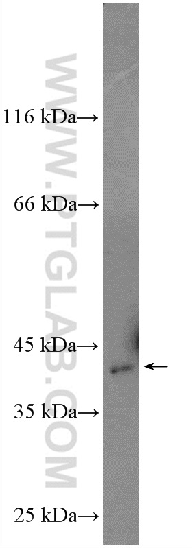 Spermine synthase Polyclonal antibody