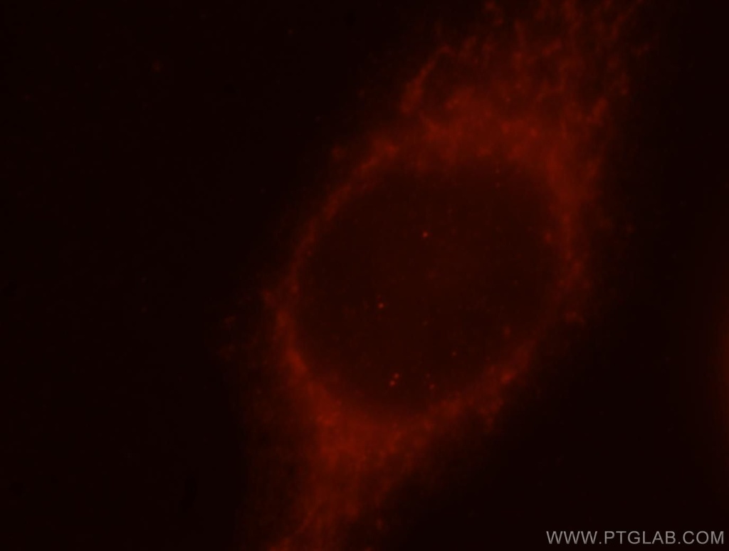 CCT7 Polyclonal antibody