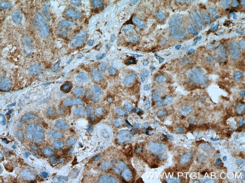 PRCP Polyclonal antibody
