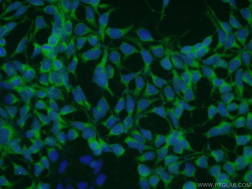 TRAPPC9 Polyclonal antibody