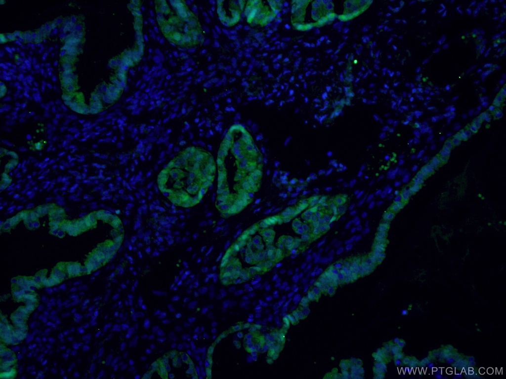 S100A1 Polyclonal antibody