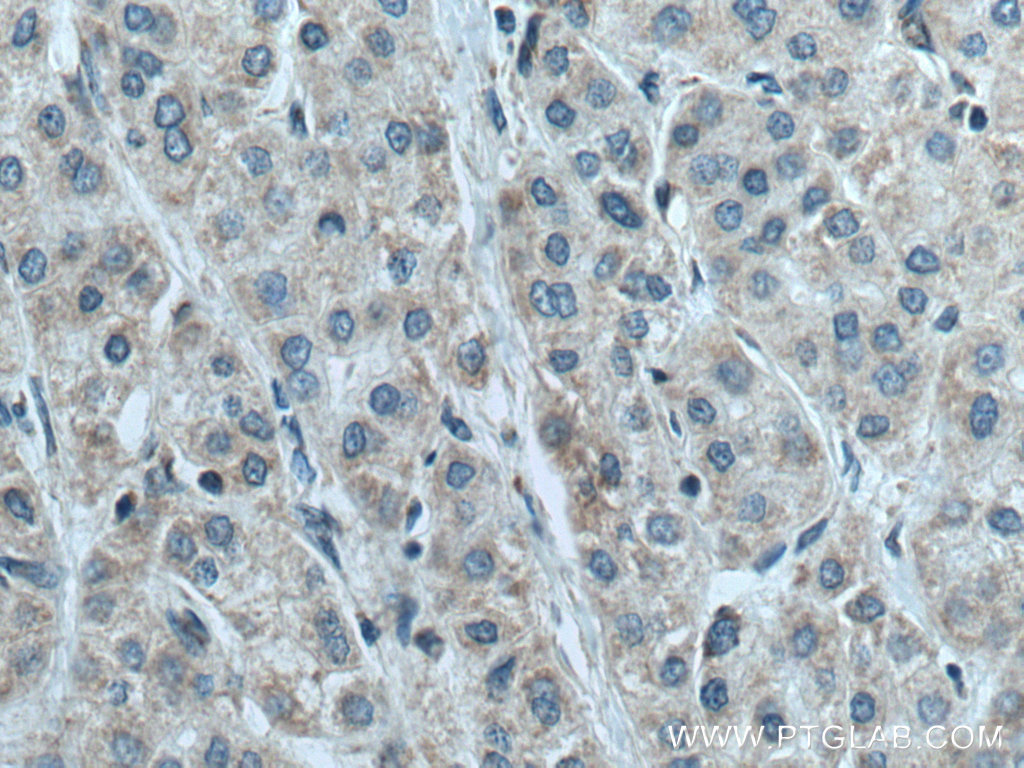 NDUFB6 Polyclonal antibody