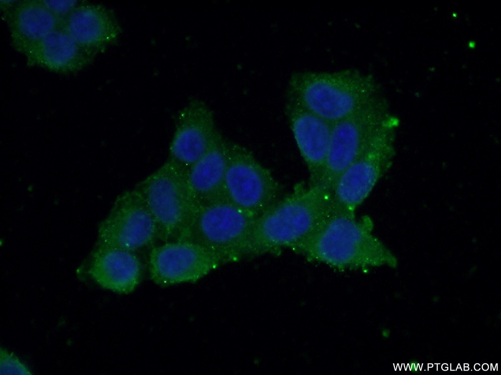 LYPLA1 Polyclonal antibody