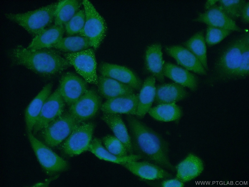 NMD3 Polyclonal antibody