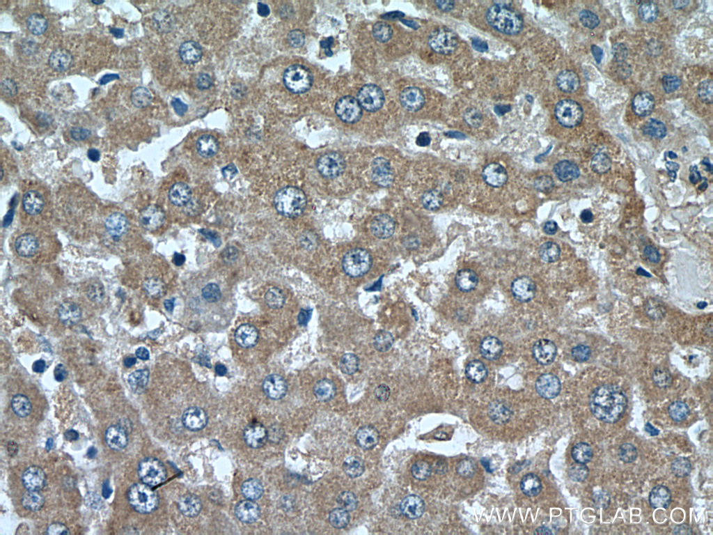 CYP39A1 Polyclonal antibody