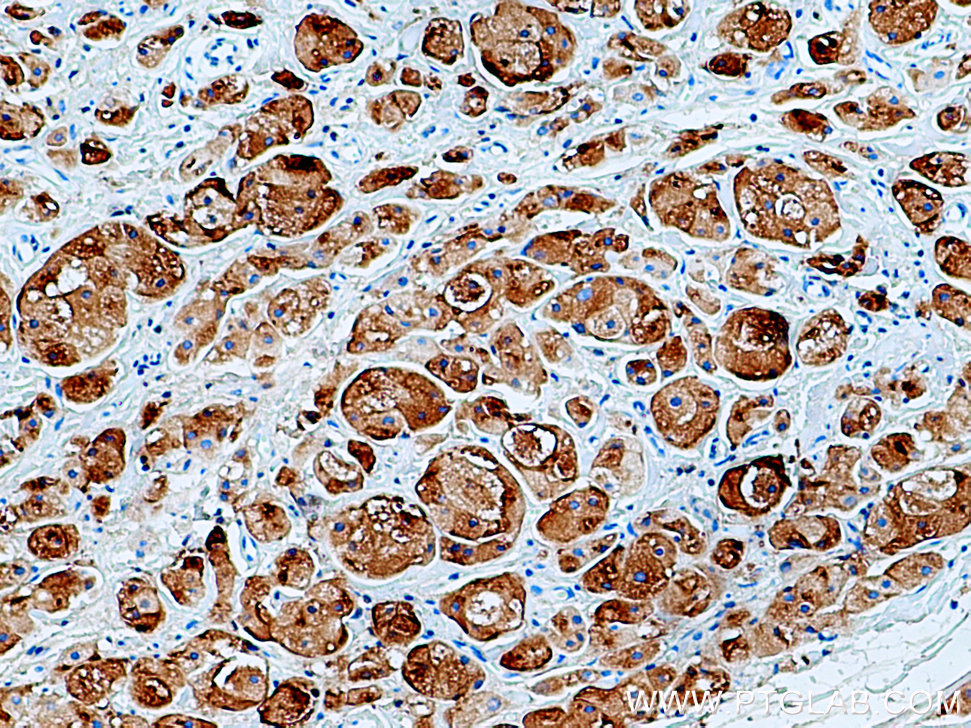 GCDFP-15/PIP Polyclonal antibody
