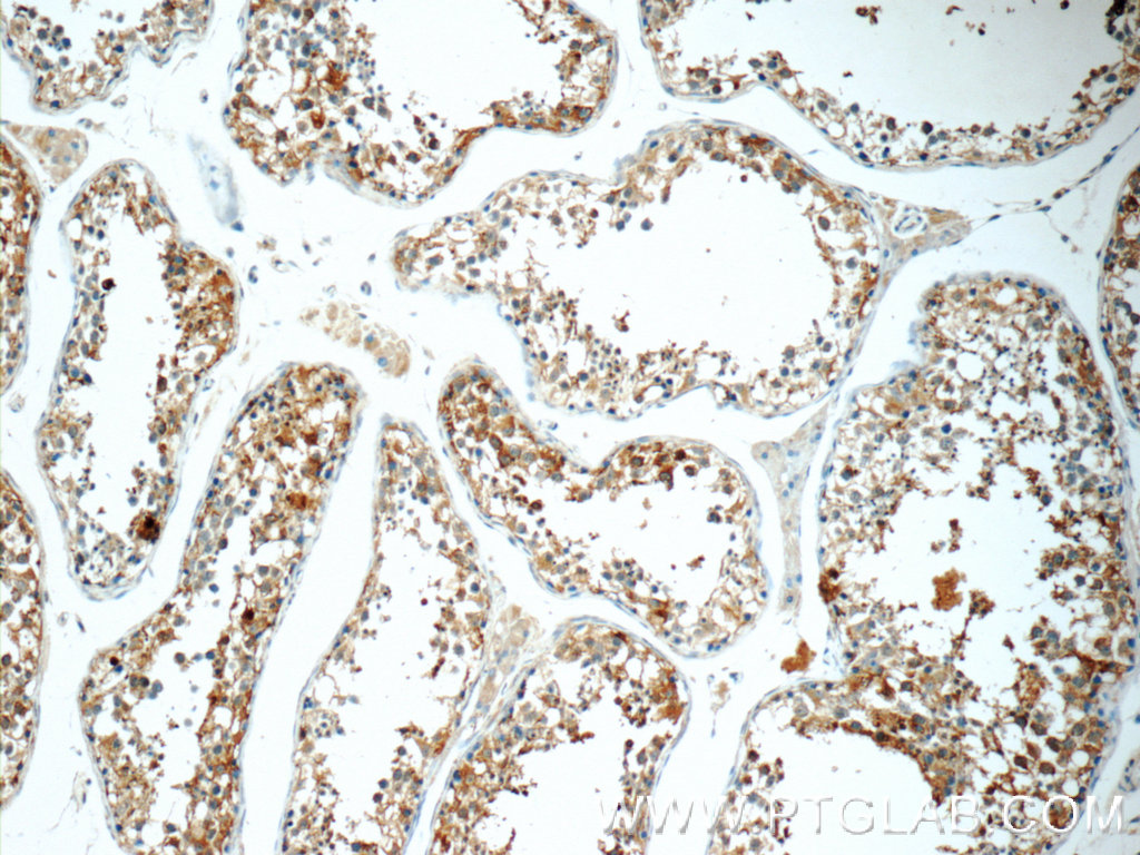 TCN1 Polyclonal antibody