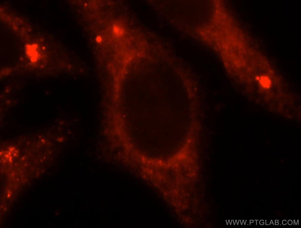 GNB2 Polyclonal antibody