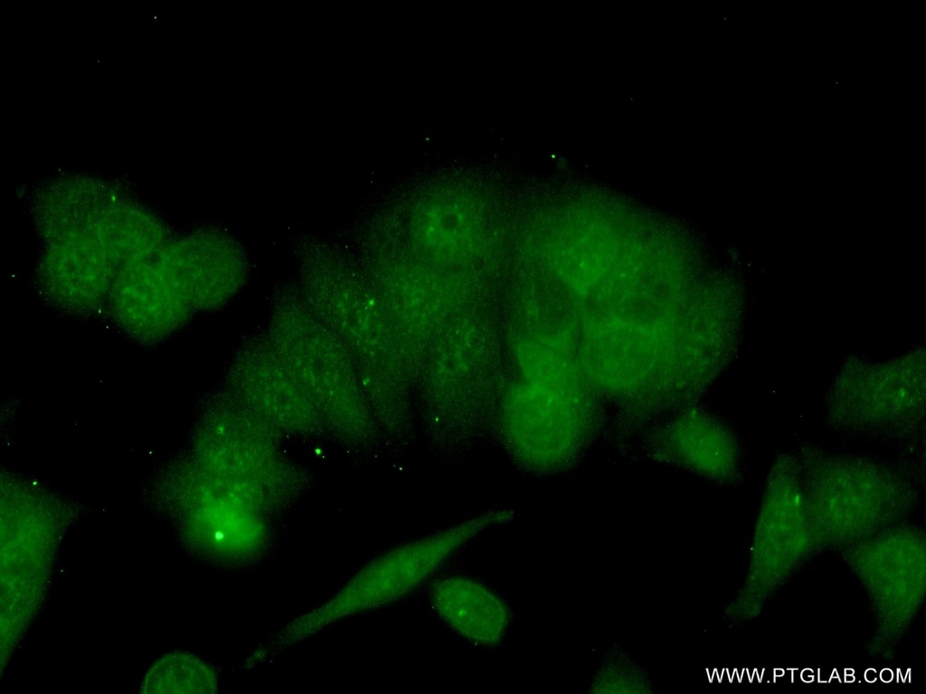 BRMS1 Polyclonal antibody