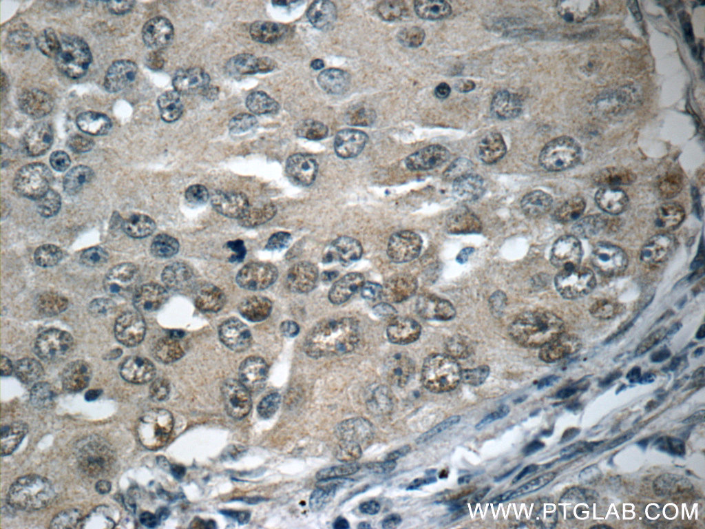 HSF1 Polyclonal antibody