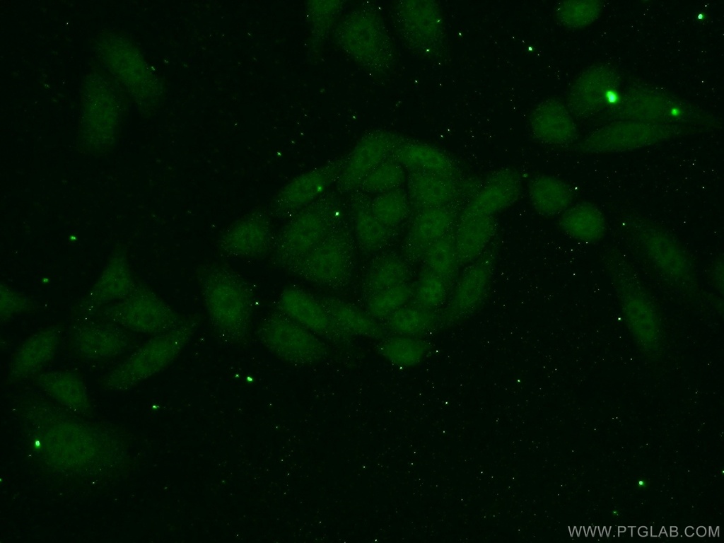 TAF11 Polyclonal antibody