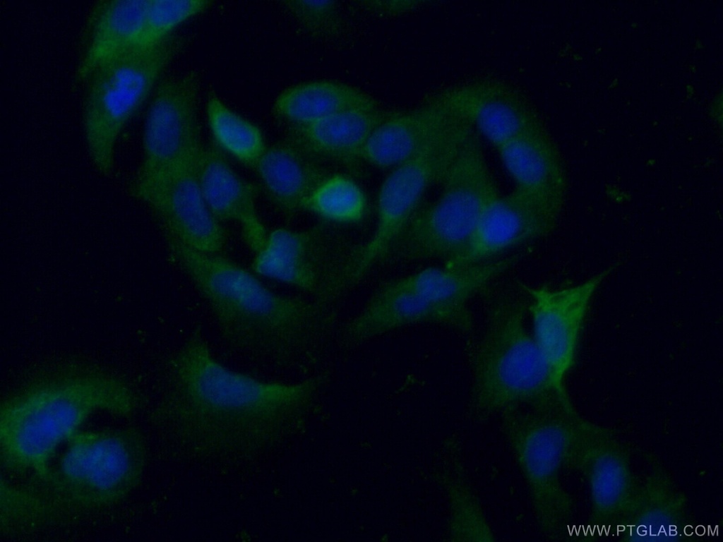 PGAM1 Polyclonal antibody