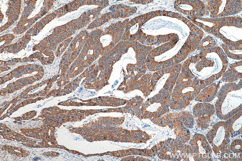 LAD1 Polyclonal antibody