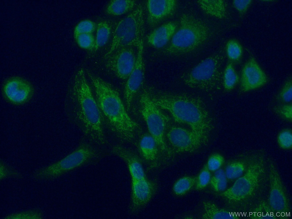 ACSF2 Polyclonal antibody
