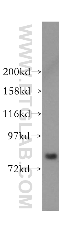 MDM1-Specific Polyclonal antibody