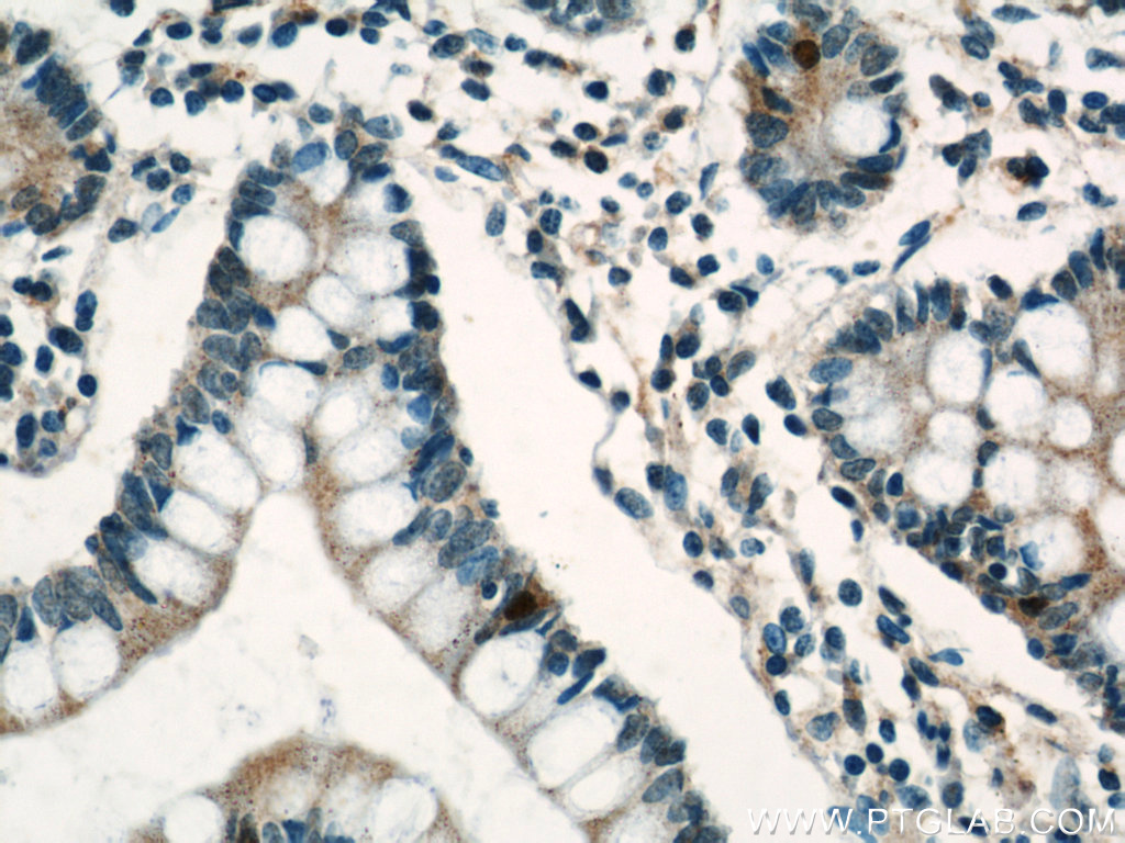 Lin28A-specific Polyclonal antibody