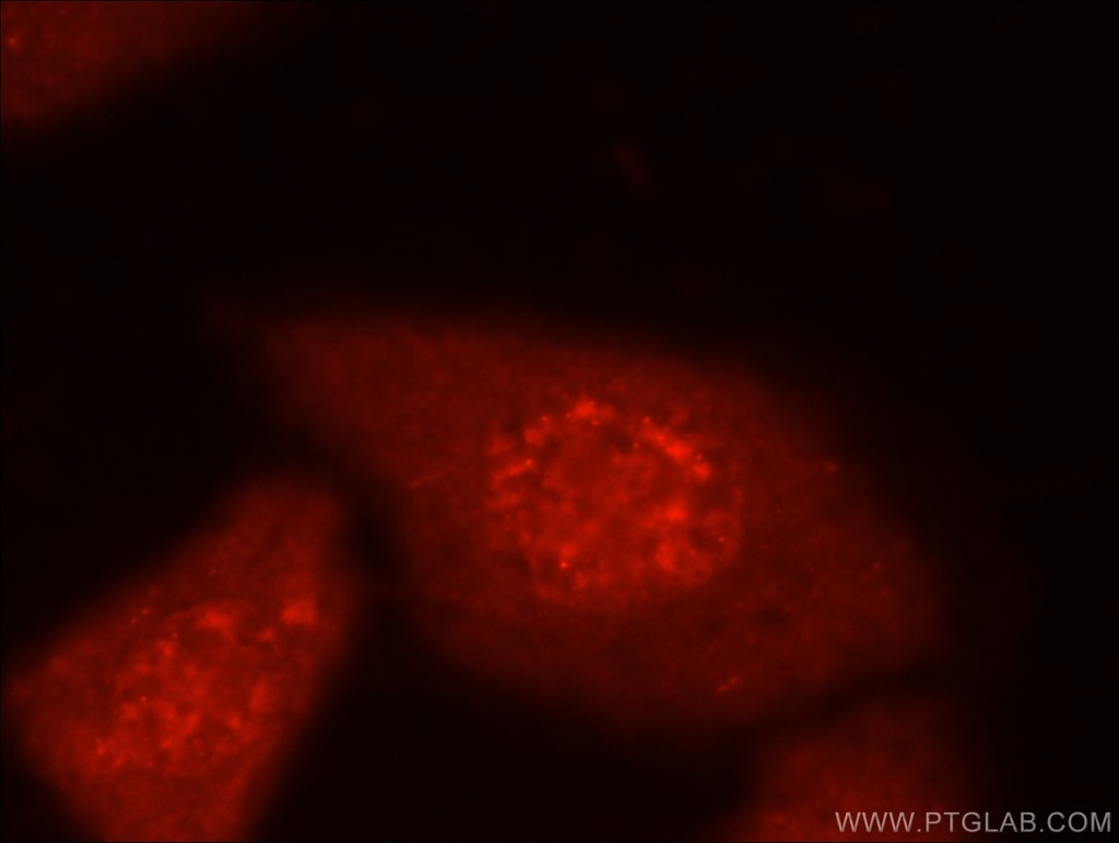 MYPN-Specific Polyclonal antibody