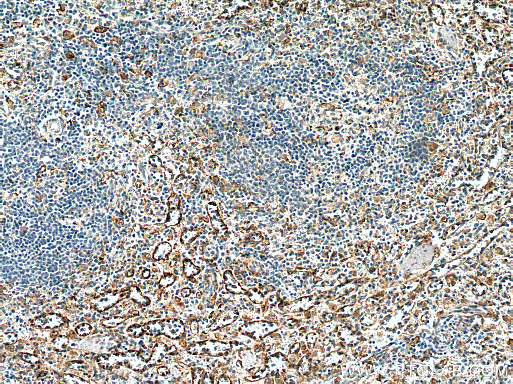 FcRn-Specific Polyclonal antibody