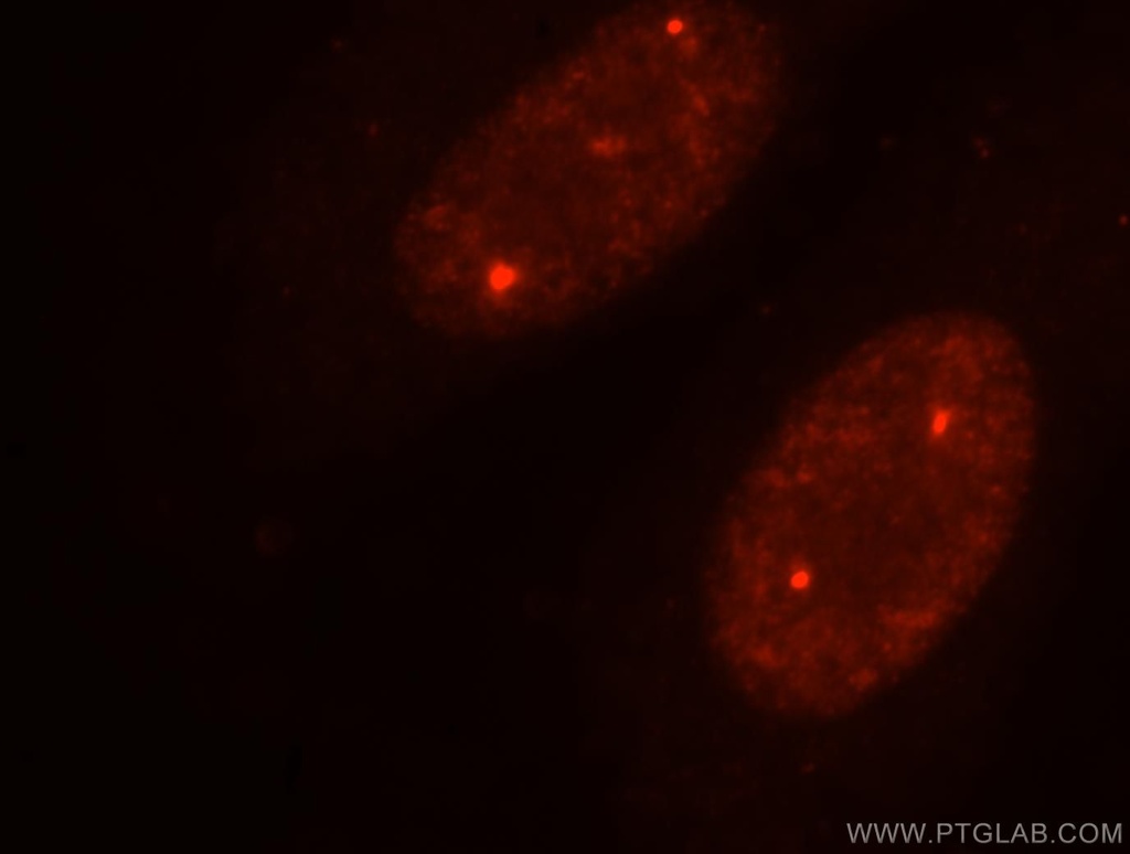 TOE1 Polyclonal antibody