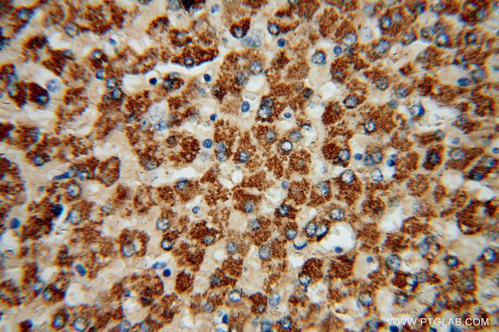ACSS3 Polyclonal antibody