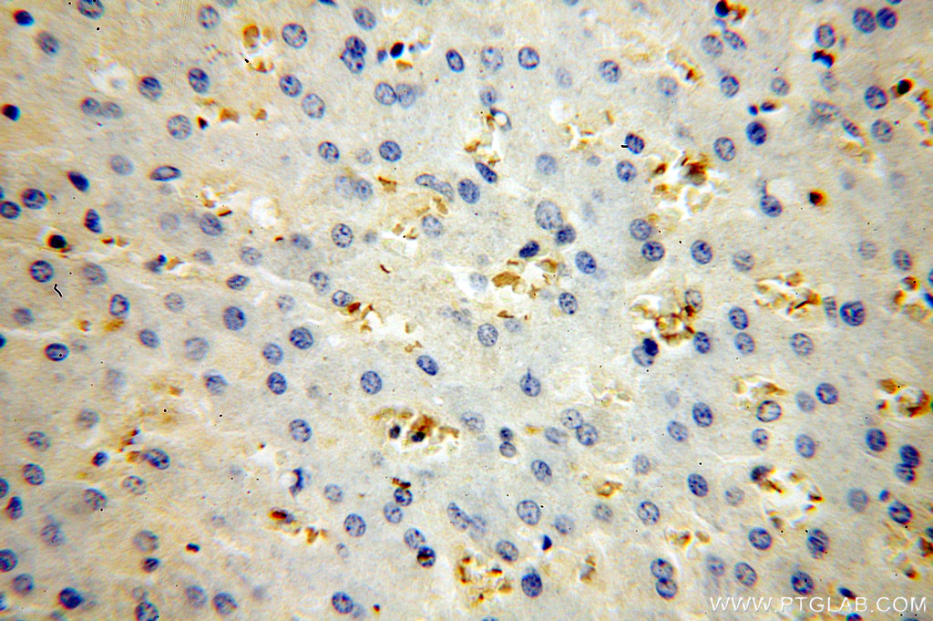 HBB Polyclonal antibody