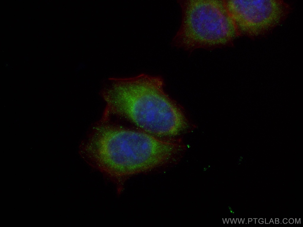 MCL1 Polyclonal antibody