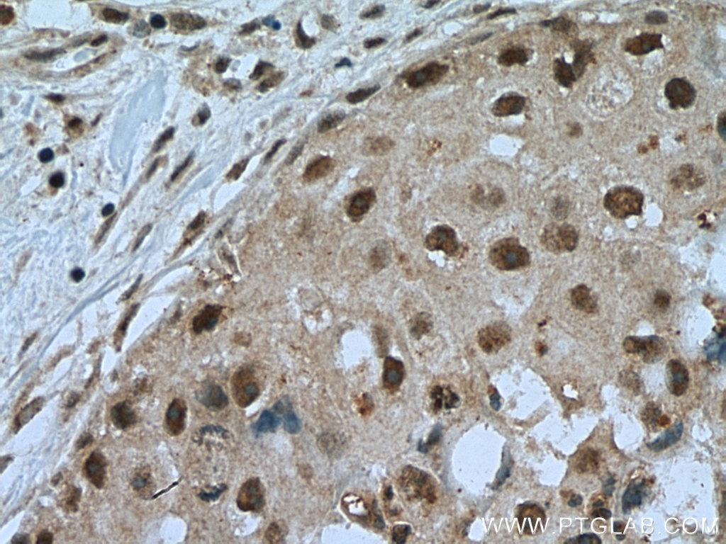 TINP1 Polyclonal antibody