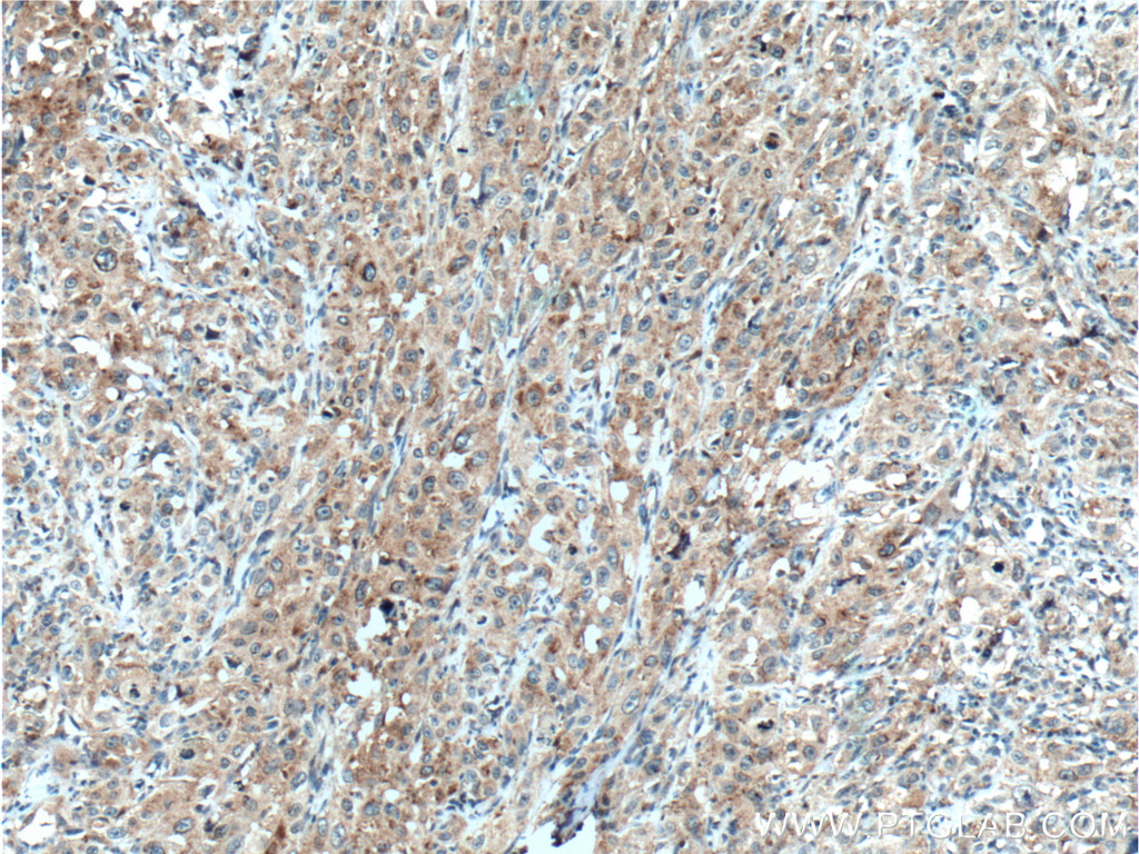SAT2 Polyclonal antibody