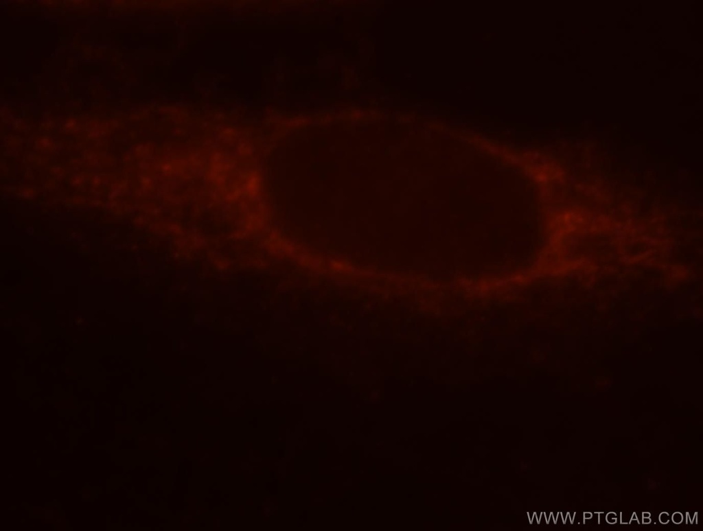LMF2 Polyclonal antibody